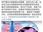 六旬大爷肺上突然多出三个洞，竟是这个爱好惹的祸？