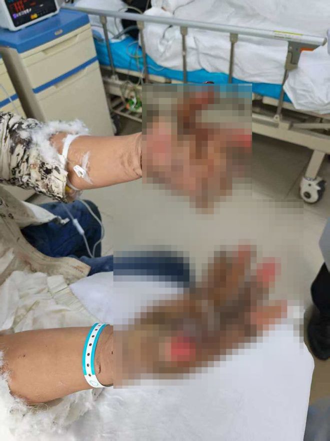 货车撞轿车事故_货车撞小车起火_