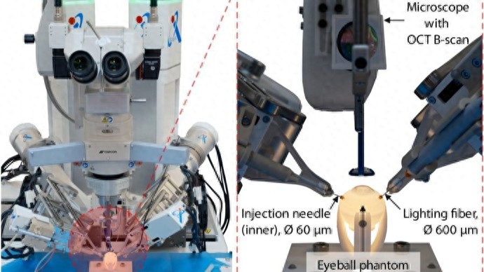 _相较医生手术平均定位误差减少近80%，眼内手术自主机器人系统研发成功_相较医生手术平均定位误差减少近80%，眼内手术自主机器人系统研发成功